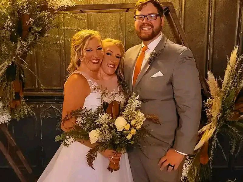 CONJOINED TWINS,ABBY HENSEL MARRIED IN A PRIVATE CEREMONY